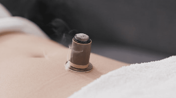 艾灸减肥 艾灸減肥的基本概念、作用機制、具體實施方案、注意事項 post thumbnail image